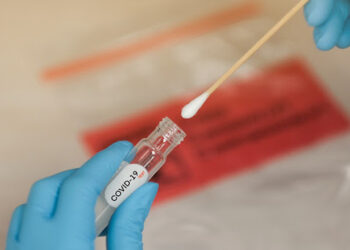 7 bước tự thực hiện test nhanh tại nhà